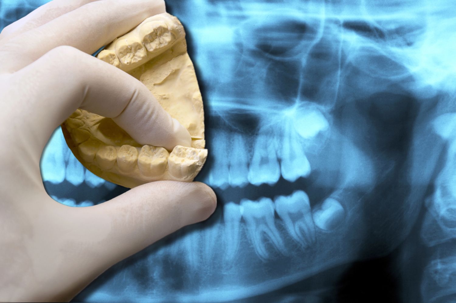 invisalign Orange County, CA